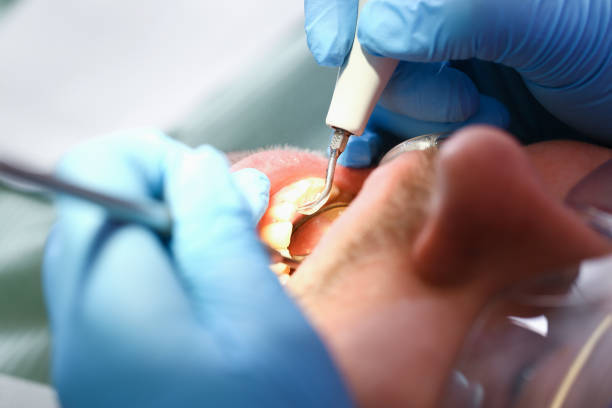 Best Urgent Tooth Repair  in Kinsley, KS