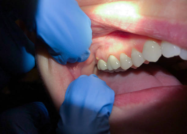 Best Emergency Gum Pain Relief  in Kinsley, KS
