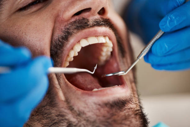 Best Walk-In Dentist Near Me  in Kinsley, KS