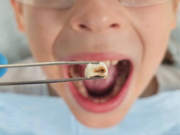 Best Affordable Emergency Dental Care  in Kinsley, KS